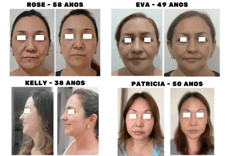Antes e depois de aluna